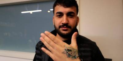 Dövme Sildirme Kabusu: Genç Adamın Elinde Dokular Öldü